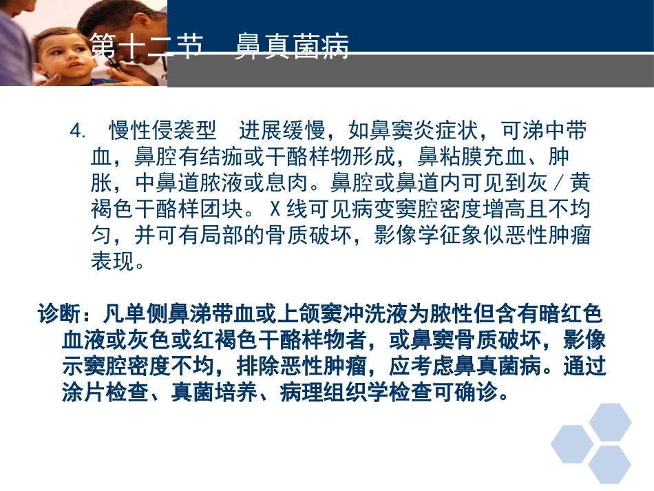 耳鼻喉科常见疾病-真菌性鼻窦炎_第7页