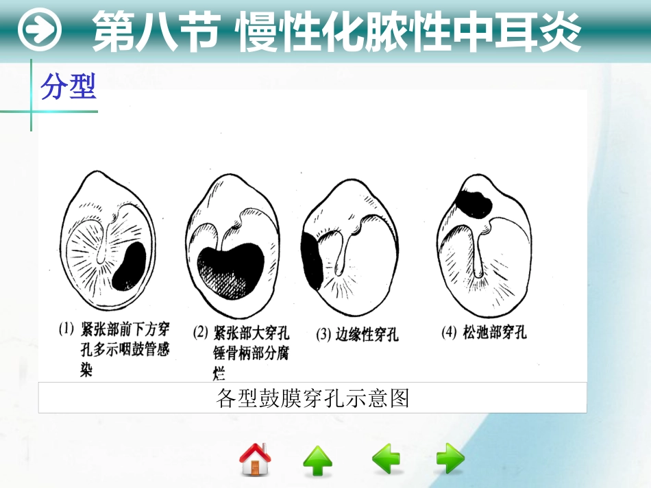 耳部疾病_第11页
