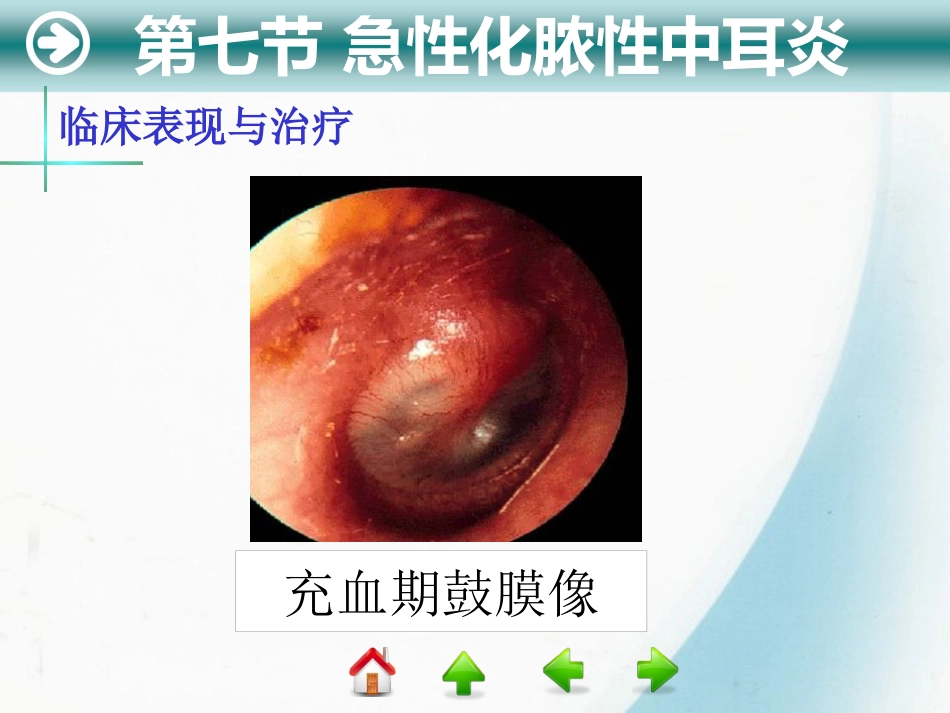 耳部疾病_第5页