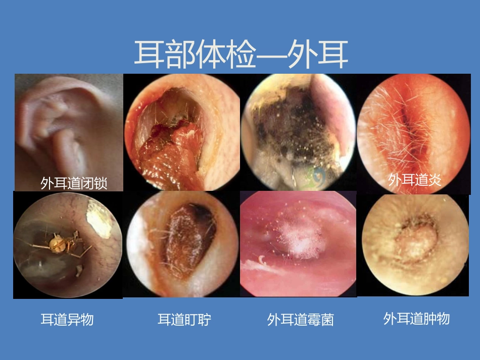 耳鼻喉科体检_第10页