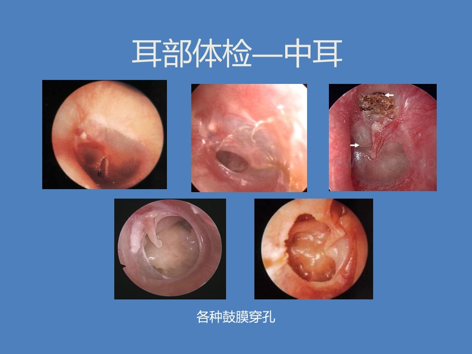 耳鼻喉科体检_第12页