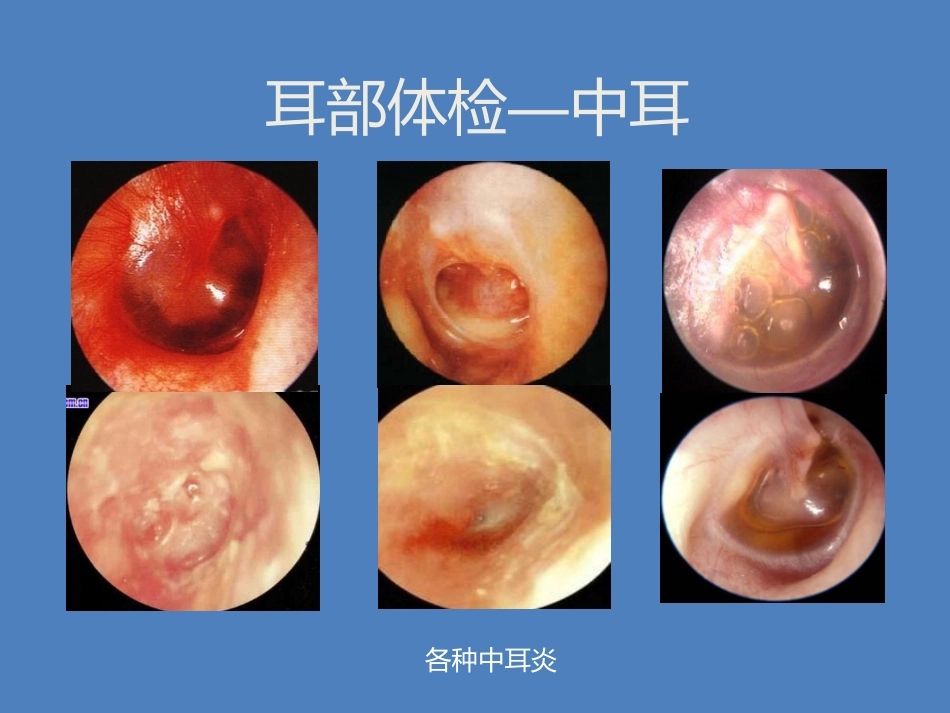 耳鼻喉科体检_第13页