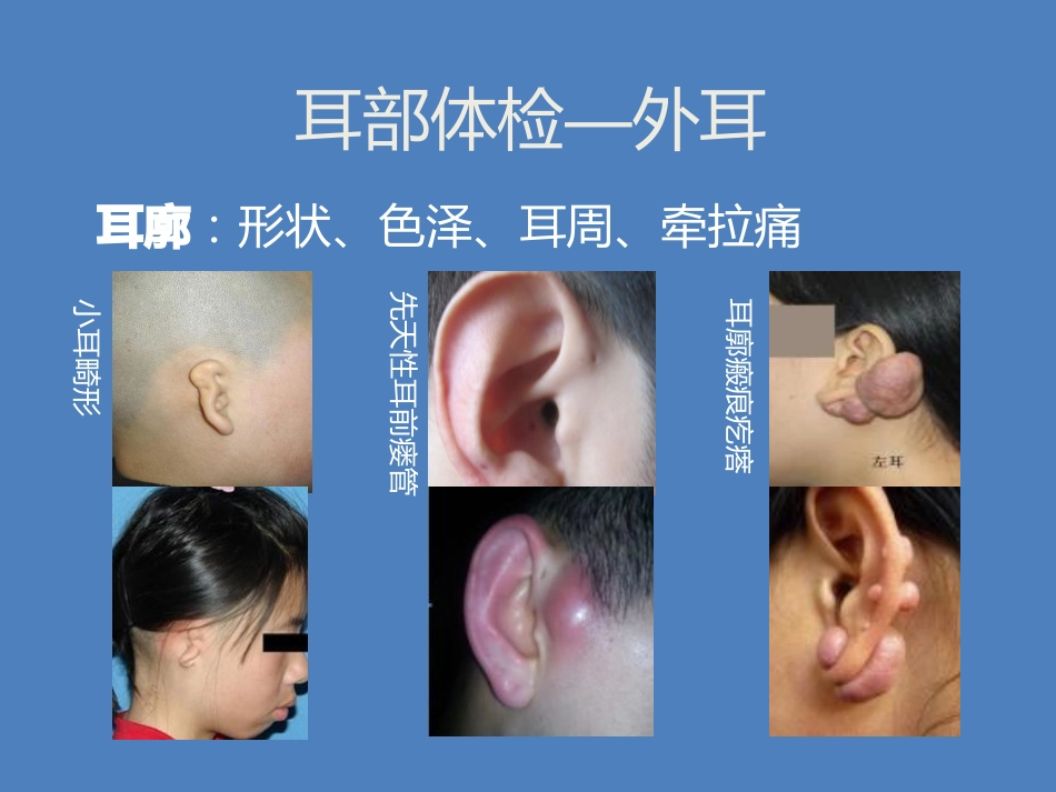 耳鼻喉科体检_第7页