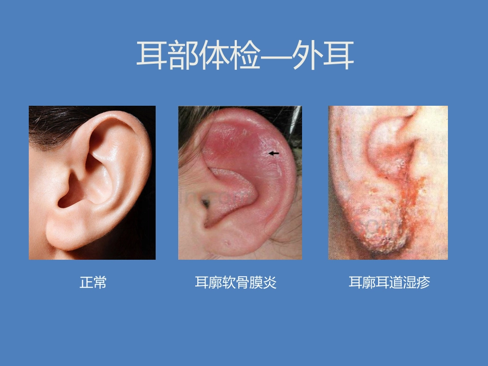 耳鼻喉科体检_第8页