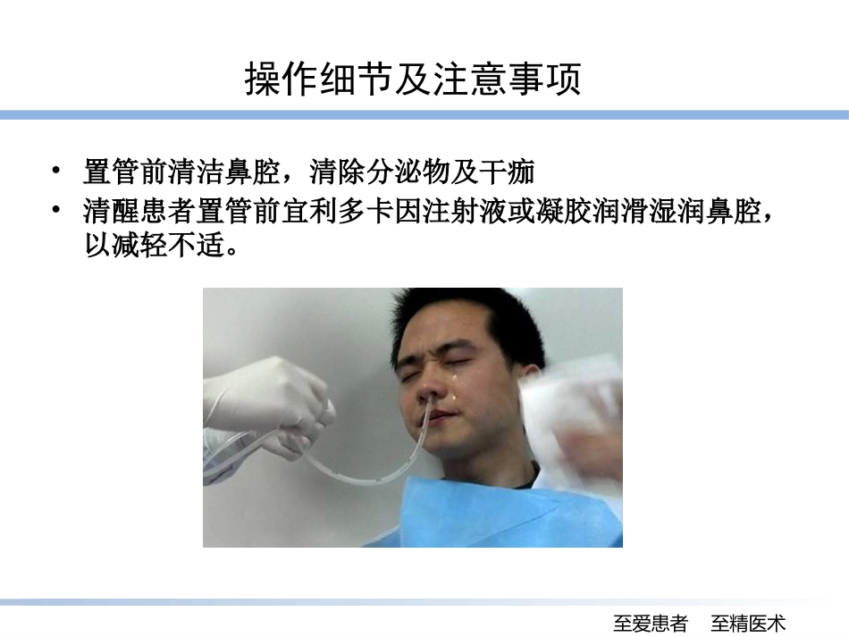 床旁盲插鼻肠管的技巧_第9页