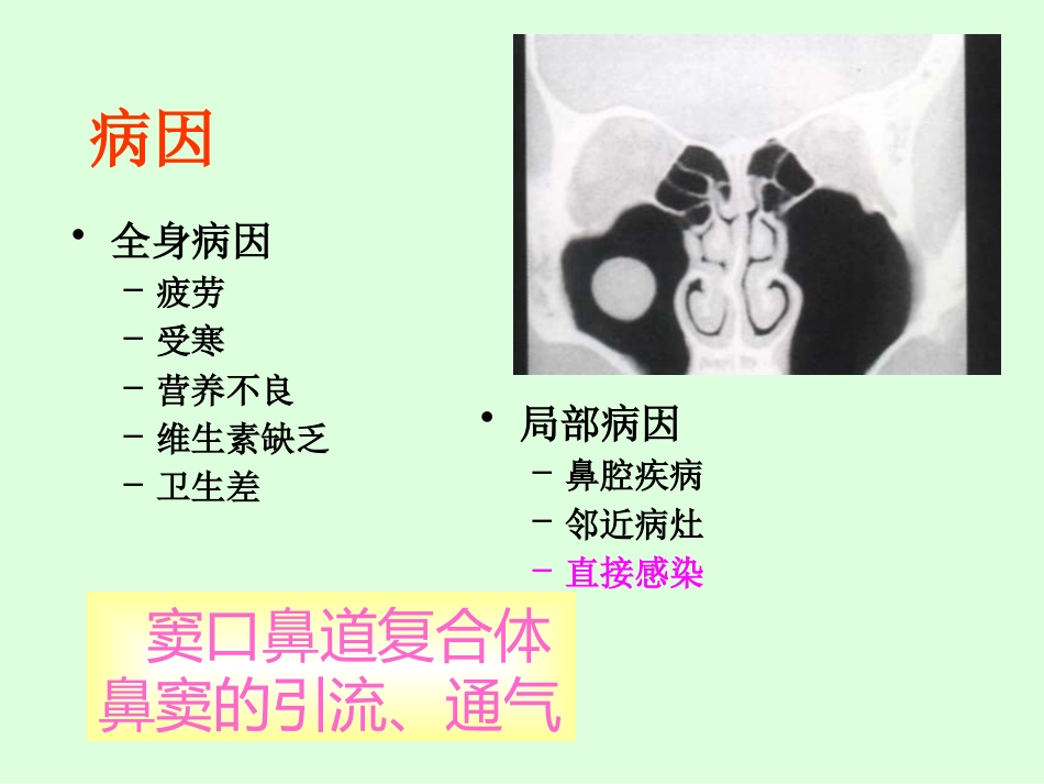 sinusitisacute 急性鼻窦炎_第11页
