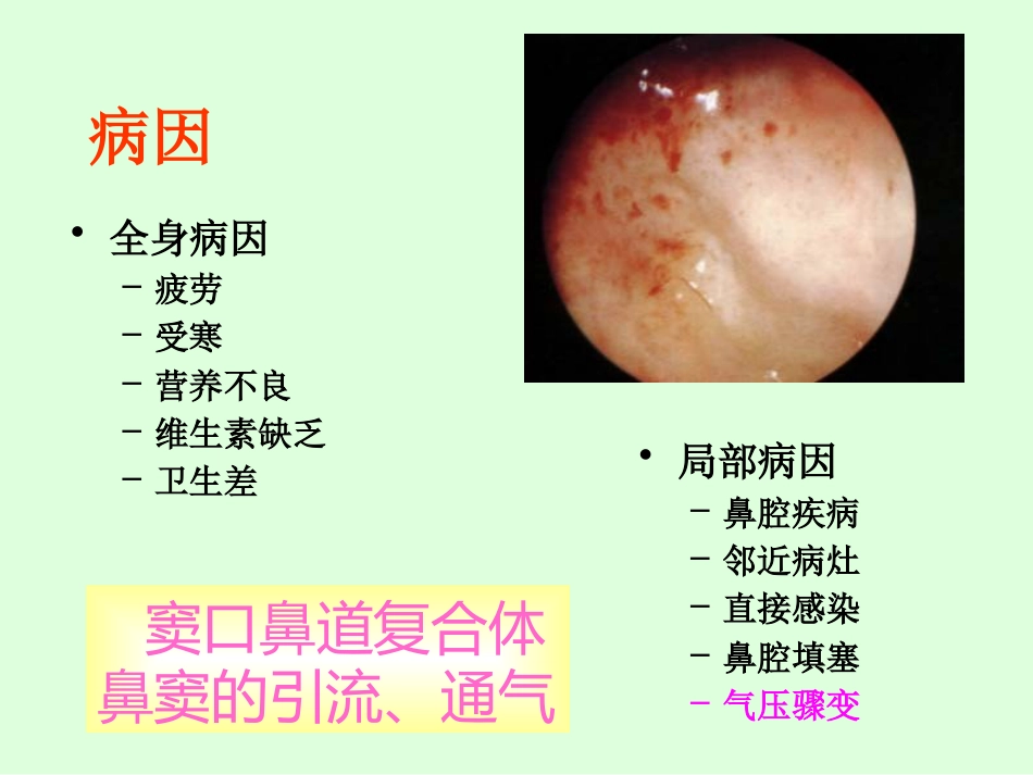 sinusitisacute 急性鼻窦炎_第13页