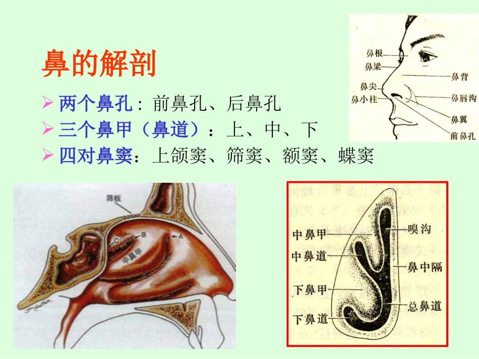 sinusitisacute 急性鼻窦炎_第2页