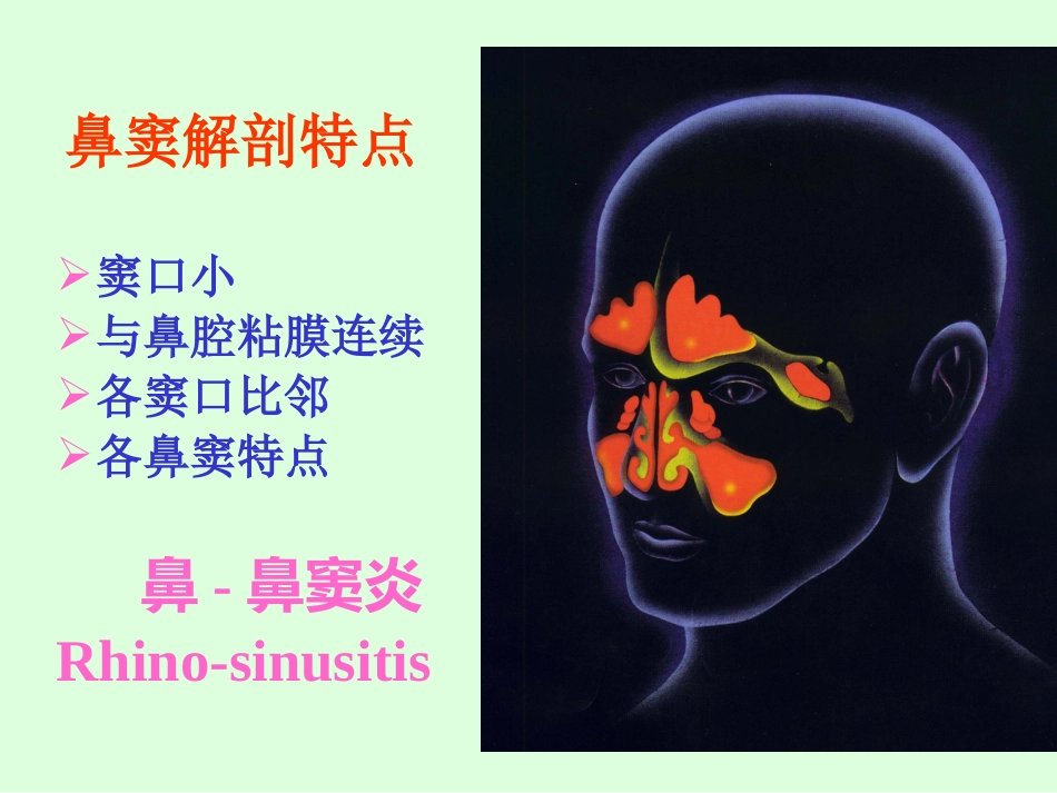 sinusitisacute 急性鼻窦炎_第6页