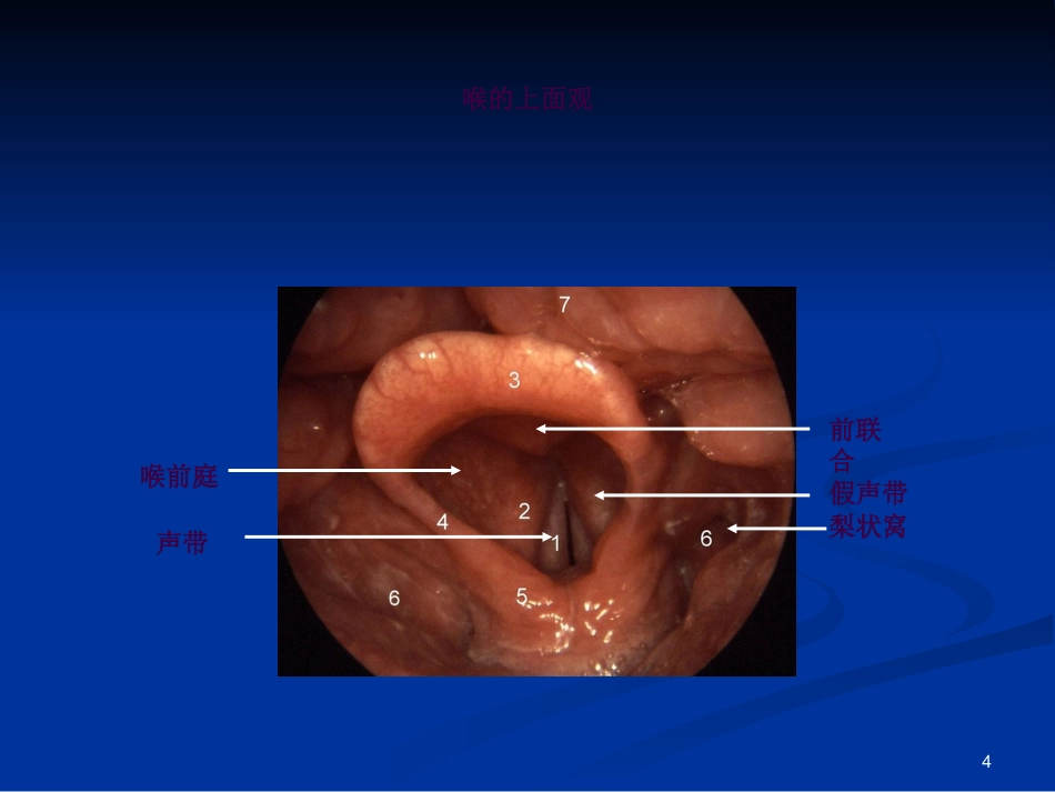 喉科学ppt课件_第4页