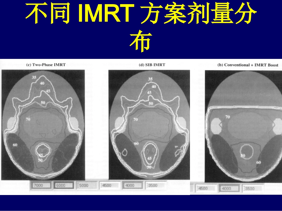 鼻咽癌调强适形放疗-惠周光_第8页