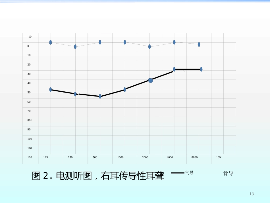高压氧在耳鼻咽喉科的应用ppt课件_第13页