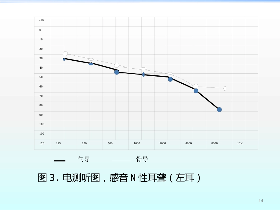 高压氧在耳鼻咽喉科的应用ppt课件_第14页
