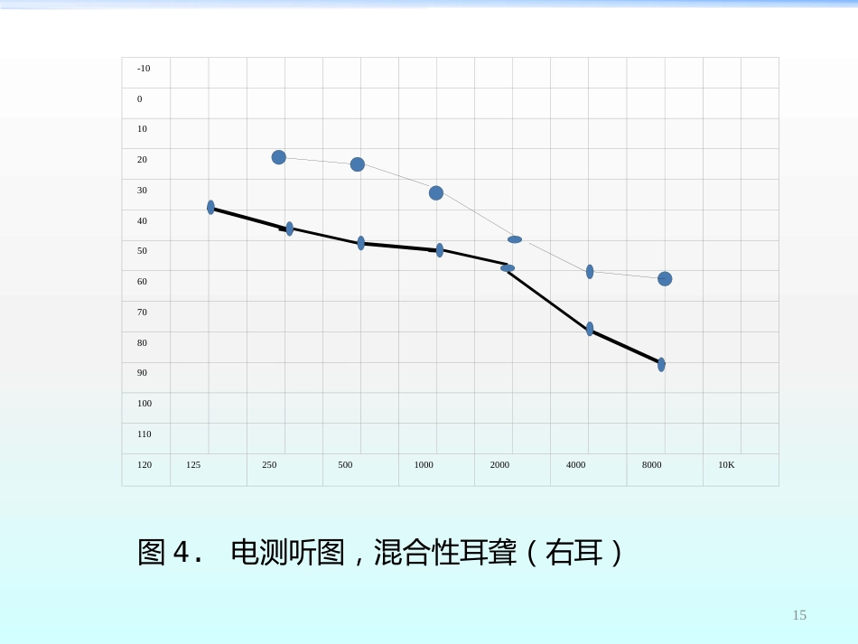 高压氧在耳鼻咽喉科的应用ppt课件_第15页