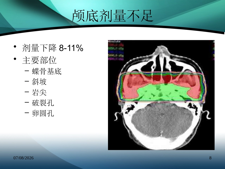 复发鼻咽癌的诊治_第8页
