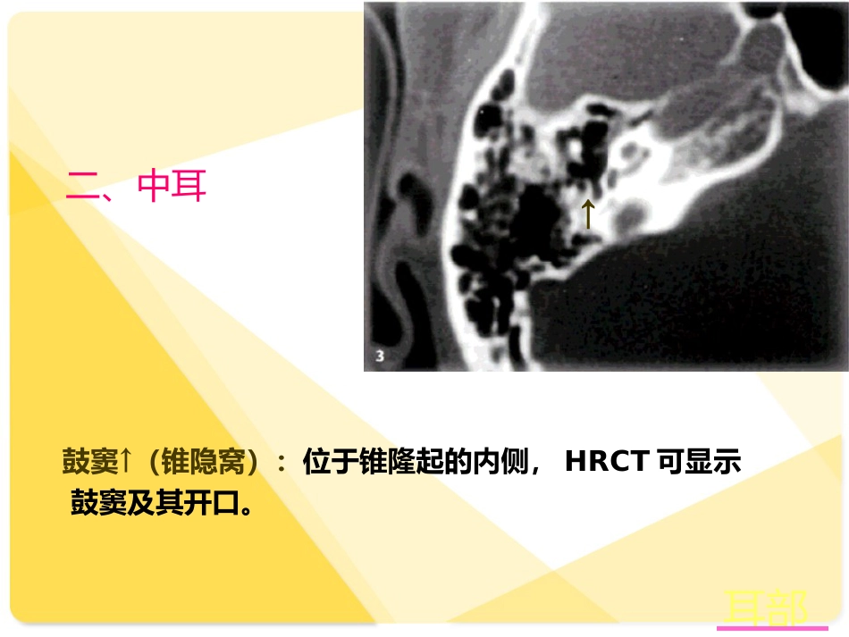 耳部解剖及常见疾病诊断_第10页