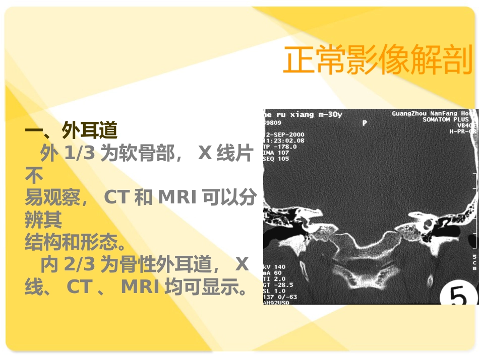 耳部解剖及常见疾病诊断_第3页