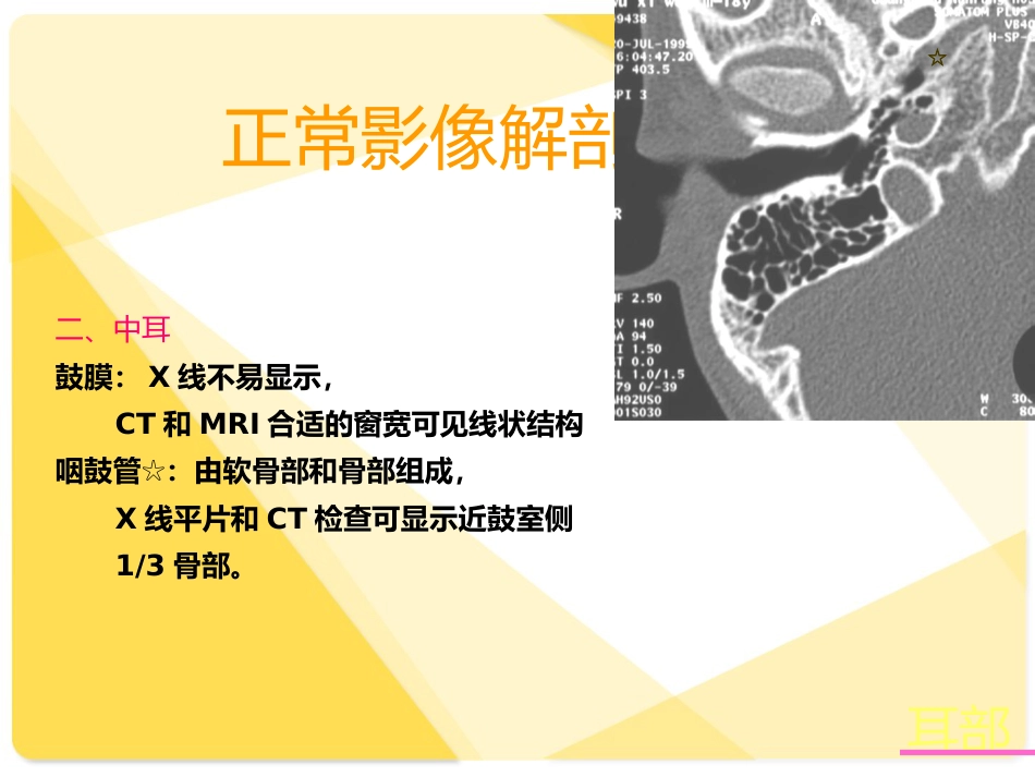 耳部解剖及常见疾病诊断_第4页