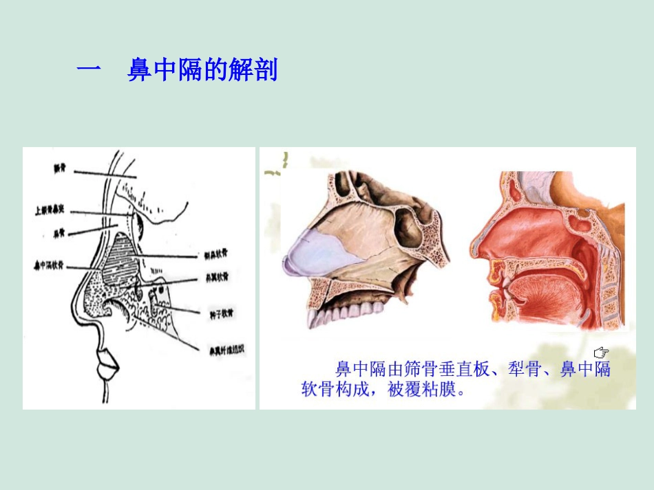 (推荐)鼻中隔偏曲矫正术张影_第3页