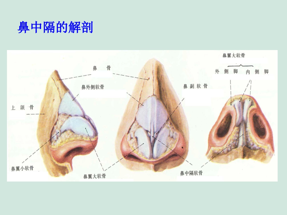 (推荐)鼻中隔偏曲矫正术张影_第4页