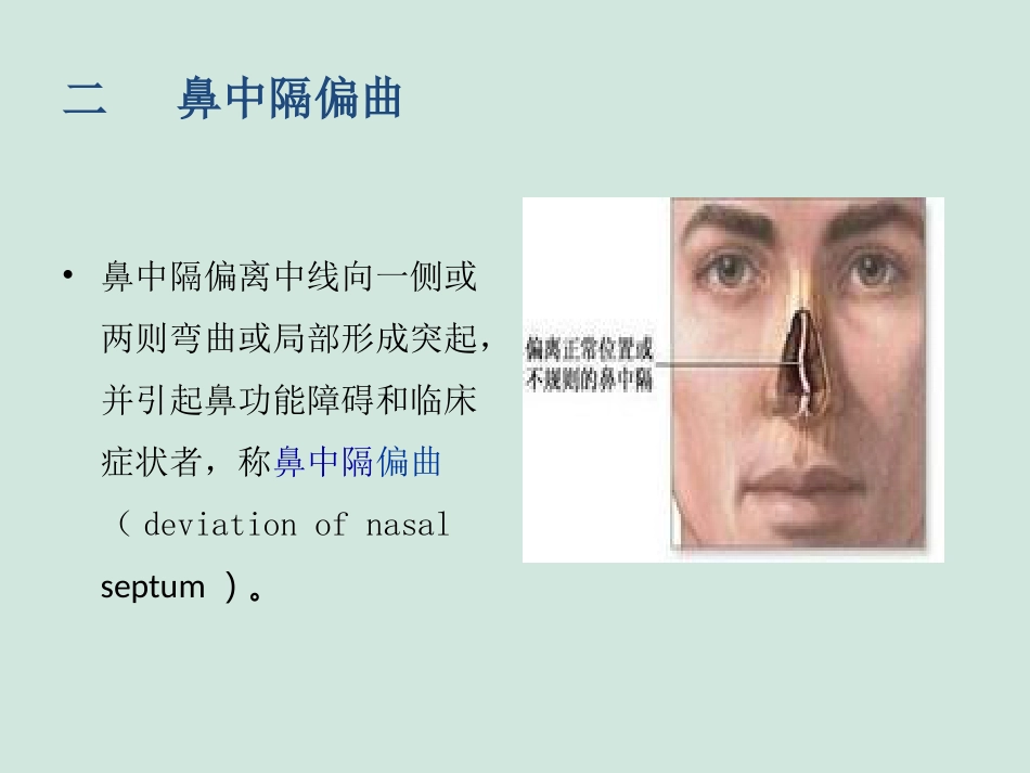 (推荐)鼻中隔偏曲矫正术张影_第6页