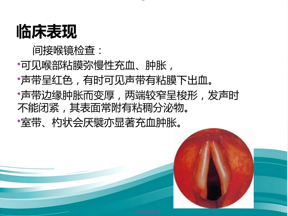 成人急性喉炎_第5页