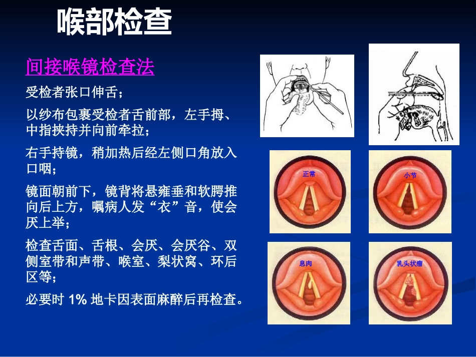 间接喉镜检查_第2页