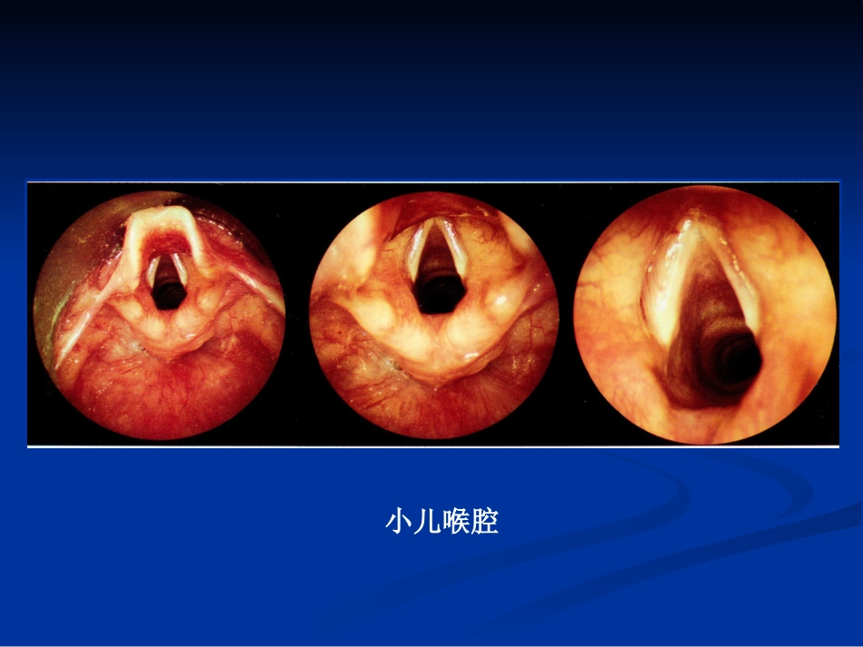 间接喉镜检查_第5页