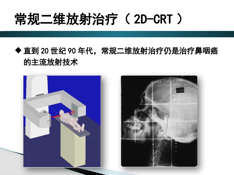 鼻咽癌调强放射治疗后晚期放射性损伤_第4页