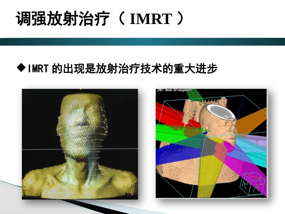 鼻咽癌调强放射治疗后晚期放射性损伤_第5页
