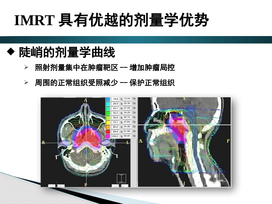 鼻咽癌调强放射治疗后晚期放射性损伤_第6页