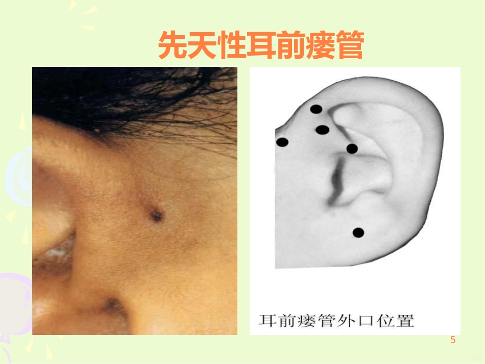 耳的结构与生理ppt课件_第5页