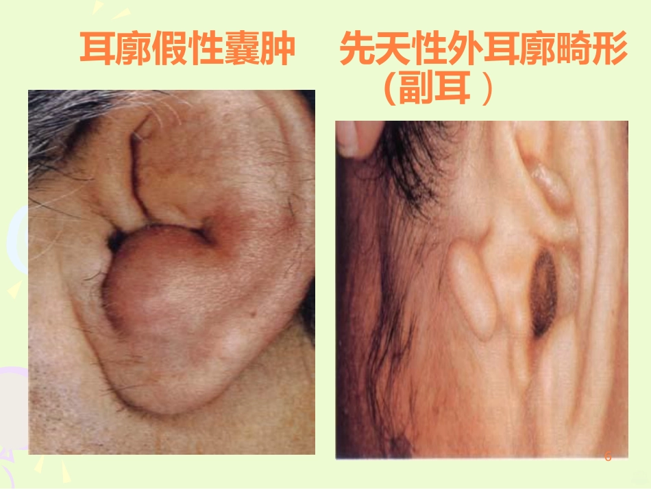 耳的结构与生理ppt课件_第6页