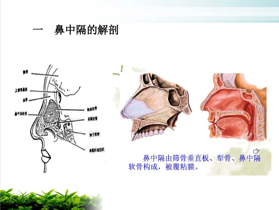 鼻中隔偏曲矫正术张影_第3页
