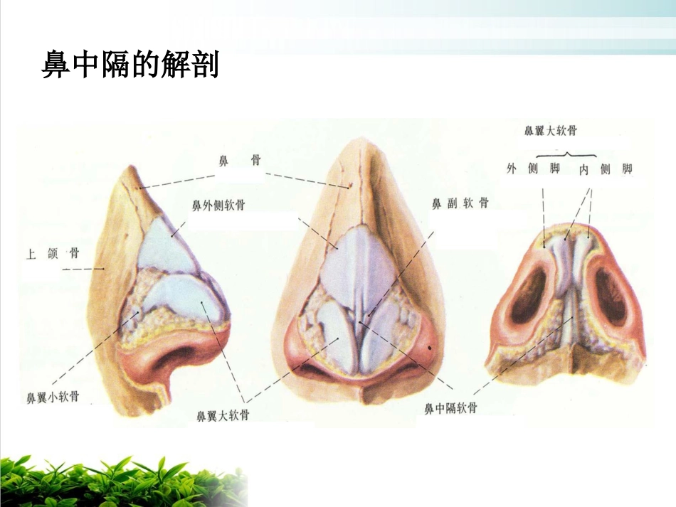 鼻中隔偏曲矫正术张影_第4页