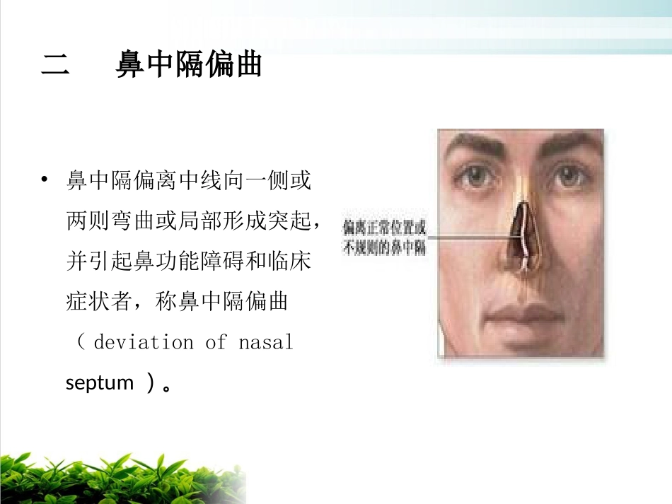 鼻中隔偏曲矫正术张影_第6页