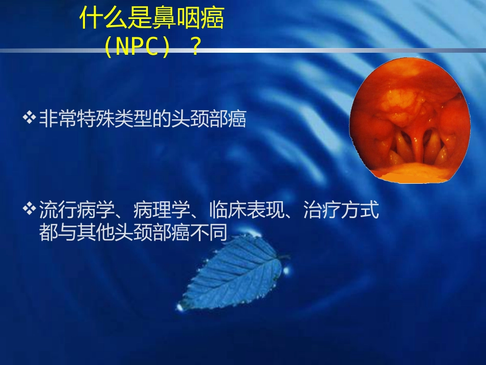 鼻咽癌的诊断与鉴别诊断_第2页
