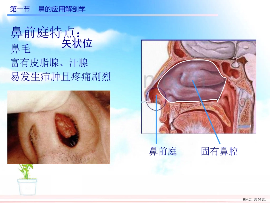 慢性鼻窦炎课件_第6页