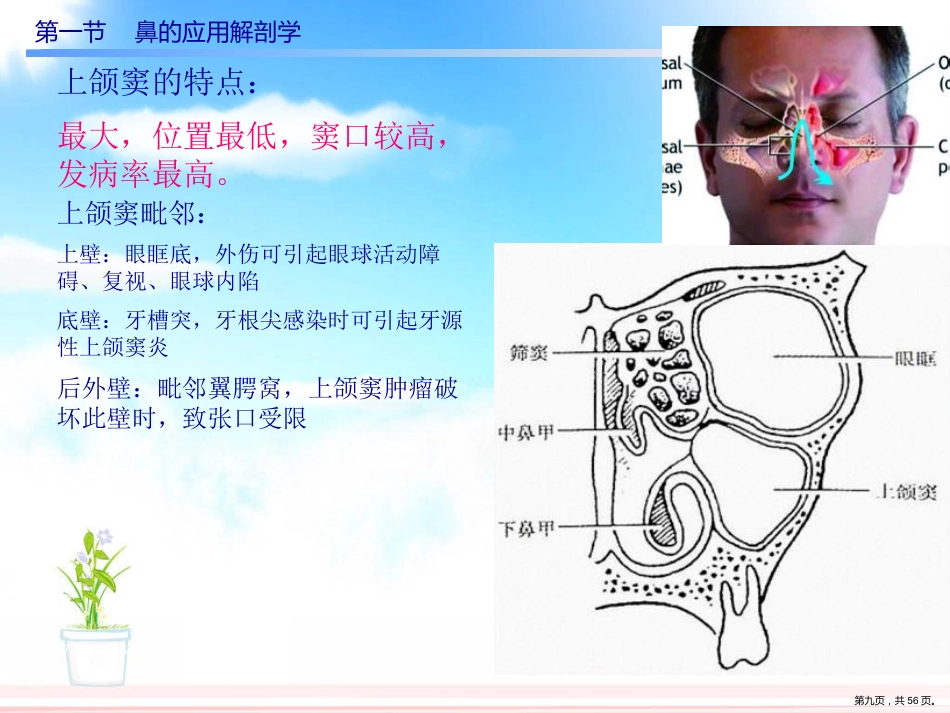 慢性鼻窦炎课件_第9页