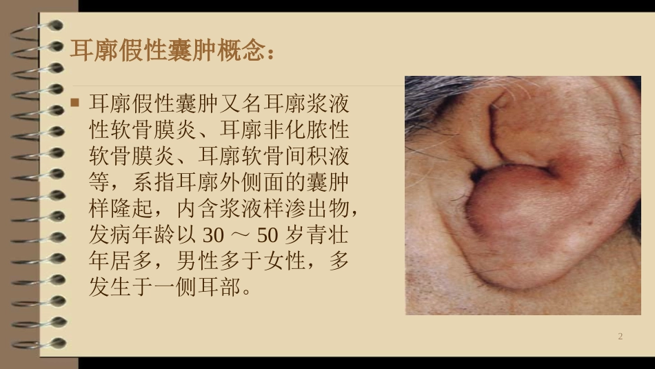 耳廓假性囊肿治疗新技术_第2页
