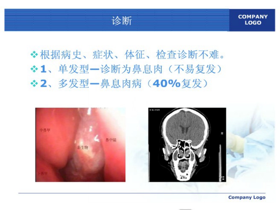 鼻息肉护理ppt课件_第11页