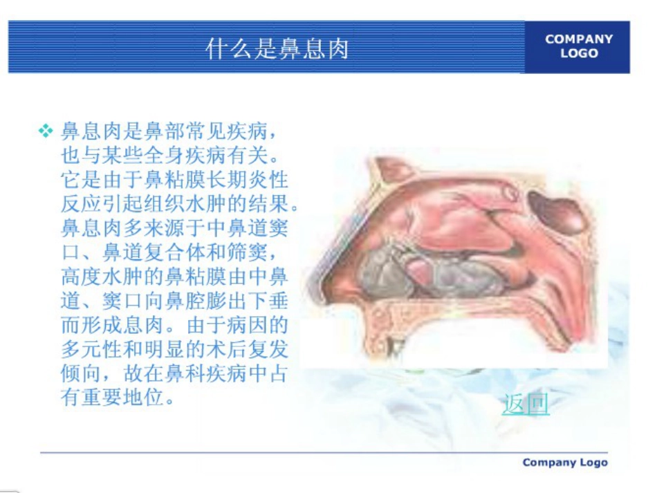 鼻息肉护理ppt课件_第2页