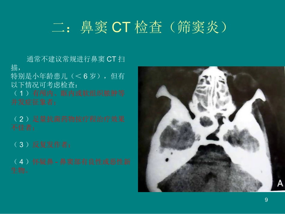 儿童鼻窦炎诊断和治疗建议ppt课件_第9页