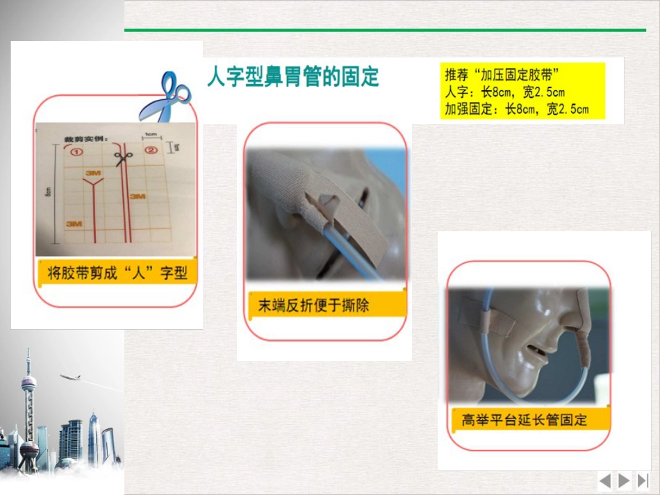 留置鼻胃管鼻饲PPT_第13页