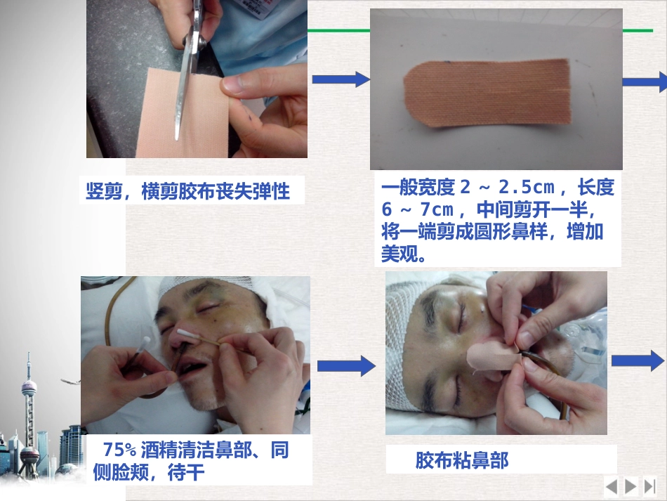 留置鼻胃管鼻饲PPT_第14页