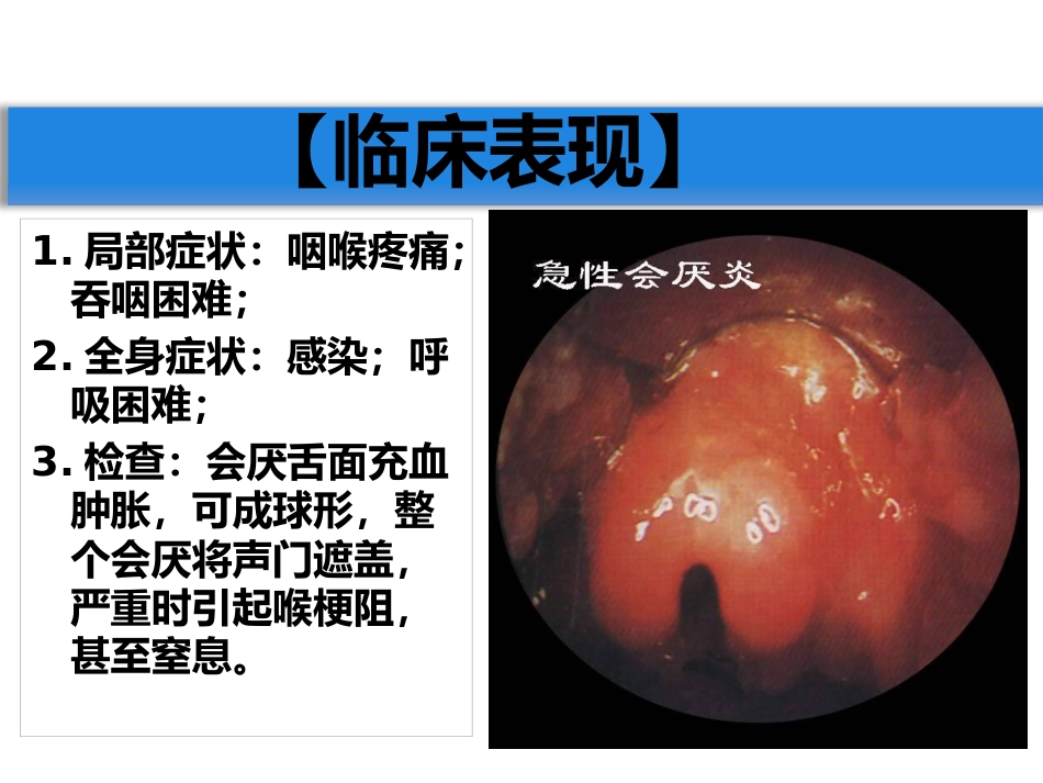 急慢性喉炎_第13页