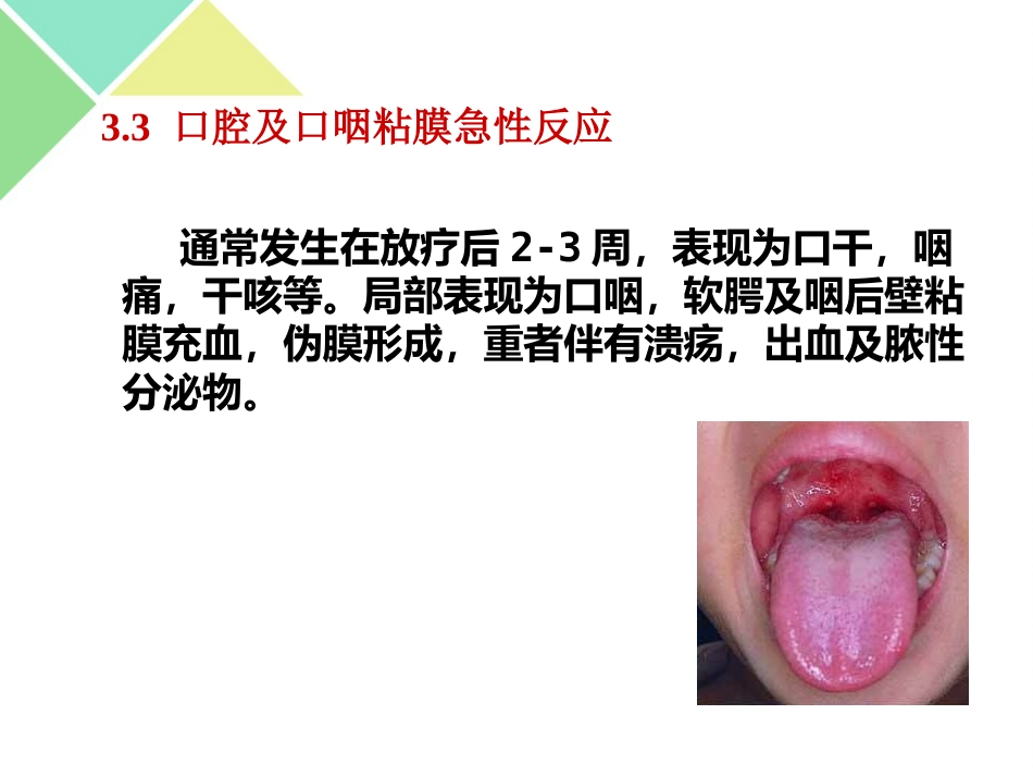 鼻咽癌的放疗护理_第15页