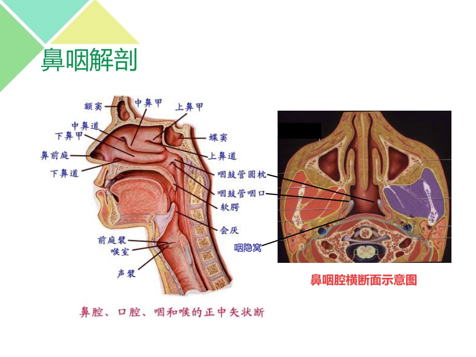 鼻咽癌的放疗护理_第3页