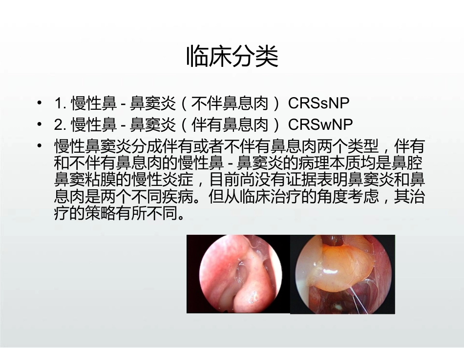 慢性鼻窦炎的治疗PPT课件_第4页