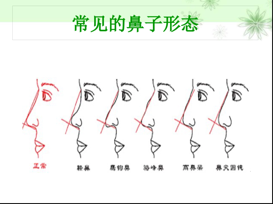 鼻部整形隆鼻术ppt课件_第5页